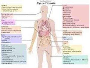 2. Fibrosis